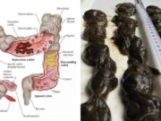 Tato kombinace vyplaví všechny toxiny a dokonale pročistí vaše střeva