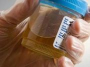 Toto přírodní super antibiotikum zničí zánět močových cest nejednou již po prvním užití