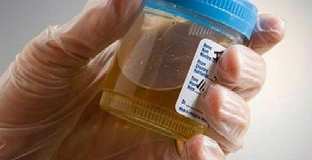 Toto přírodní super antibiotikum zničí zánět močových cest nejednou již po prvním užití (1)
