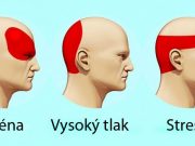 Bolí Vás často hlava? Takto se zbavíte bolesti hlavy během několika minut bez užití léků